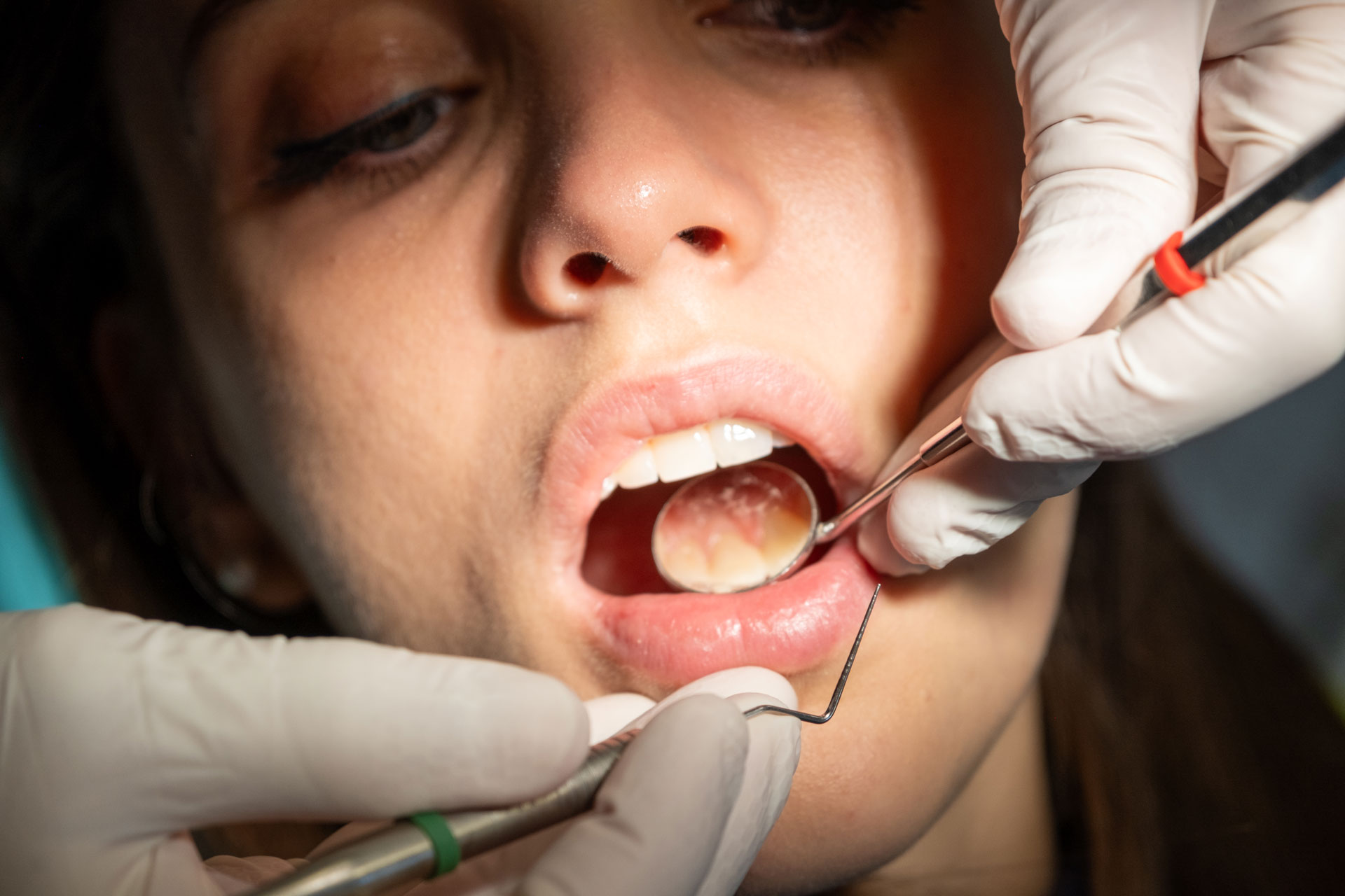 Studio dentistico Vasselli - Il tuo dentista di Trieste Odontoiatria conservativa